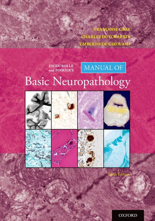 Escourolle and Poirier's Manual of Basic Neuropathology (6th edition)